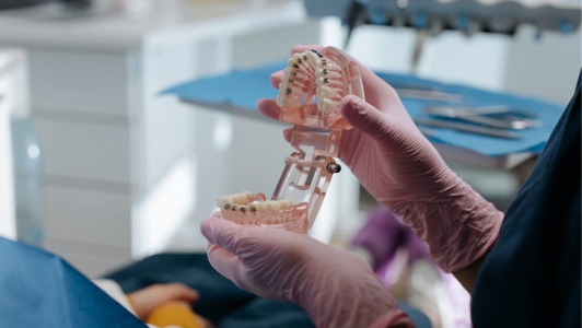 Protez Diş Nedir? Protez Diş Nasıl Uygulanır?